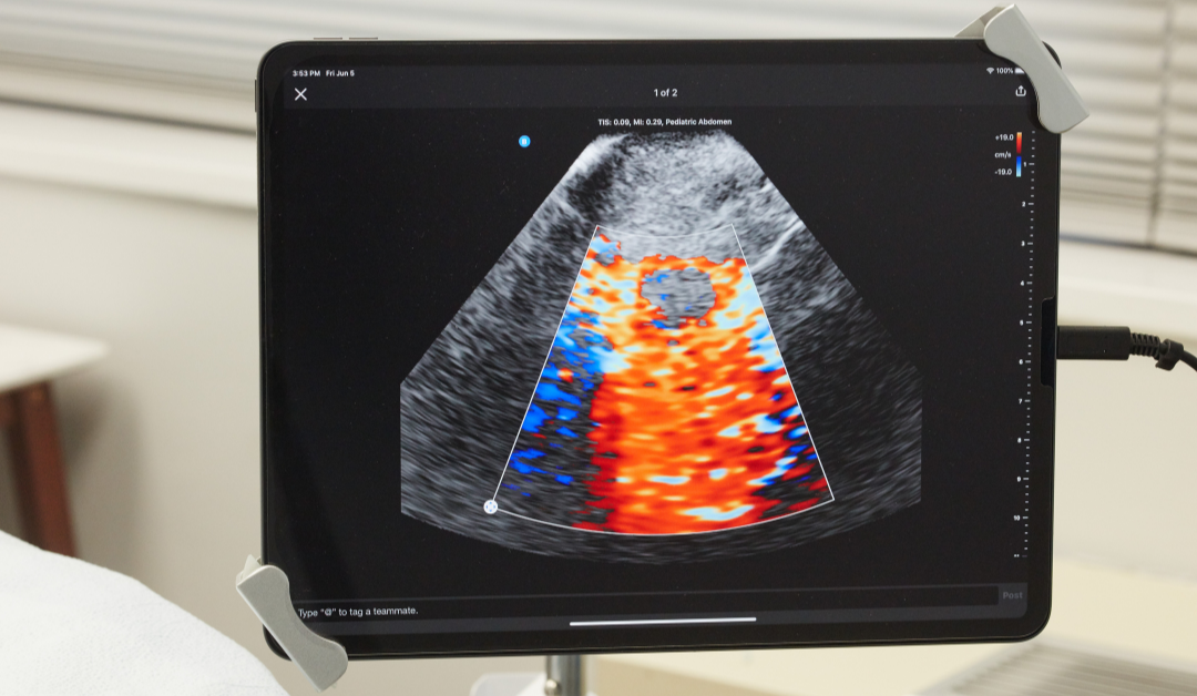 Adenomyosis