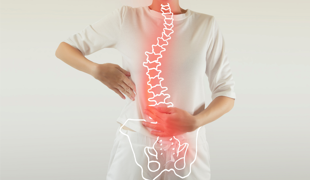 Scoliosis Pelvic Pain